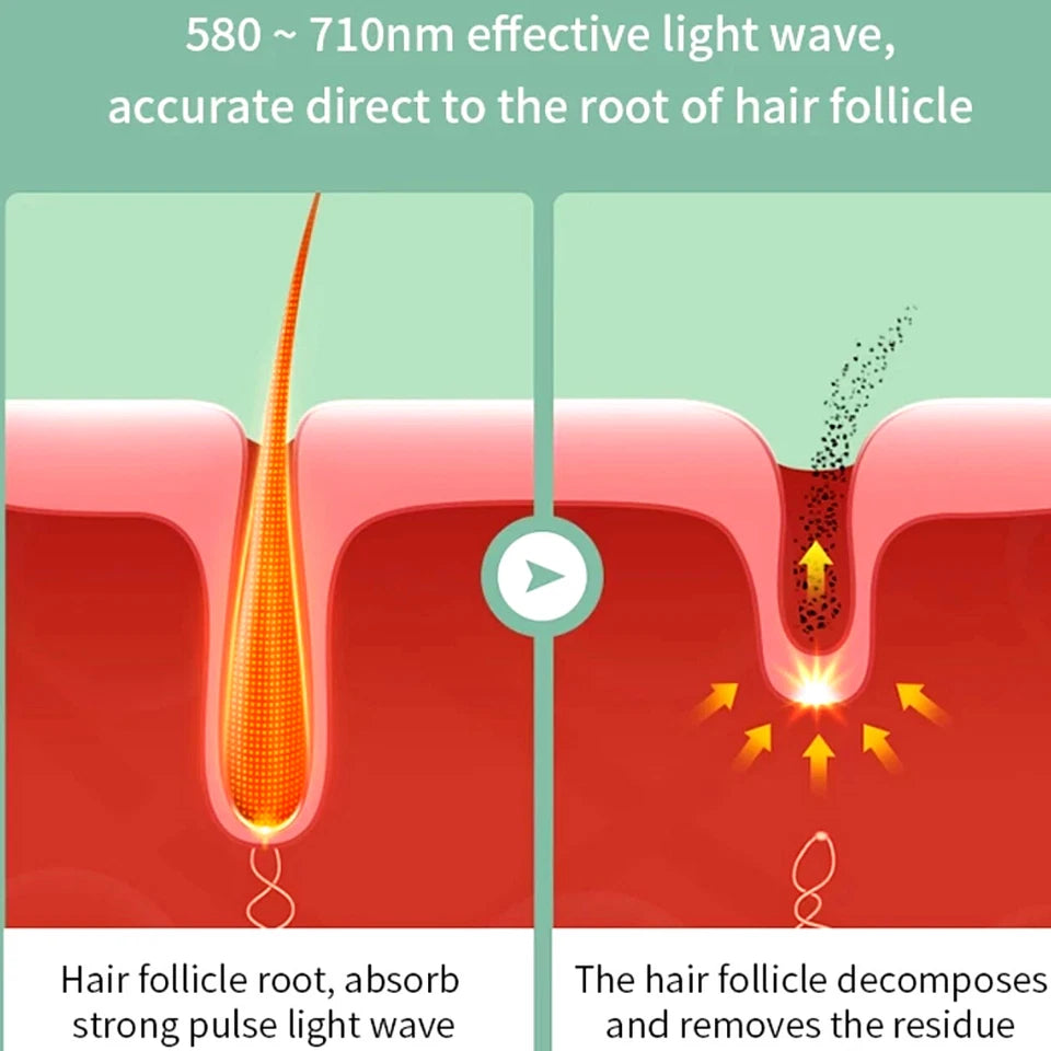 SmoothSkin™ Laser Remove